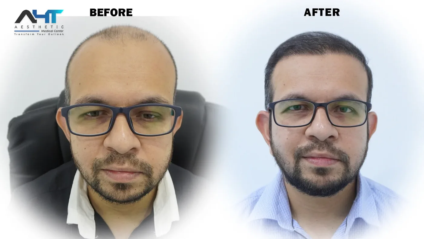 AHT Patient Result 6 before and after