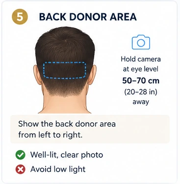 Back Donor Area photo example