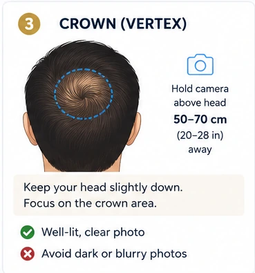 Crown photo example