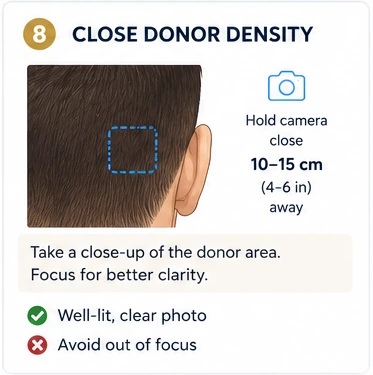Close Donor View photo example