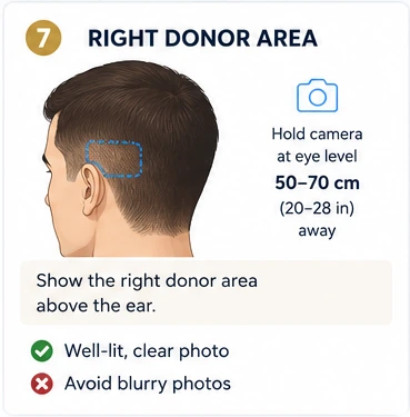 Right Donor Area photo example