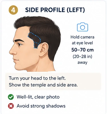 Side / Profile photo example