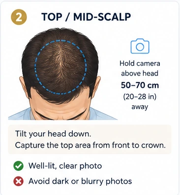 Top / Mid-scalp photo example